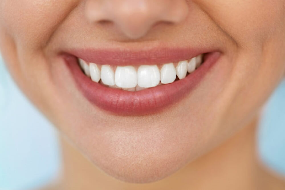 چگونه دندانهایمان را سفید کنیم؟(سفید کردن دندان با جوش‌شیرین در کمتر  از۳دقیقه)