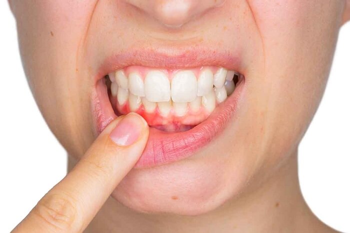 درد دندان - هاو کن یو
